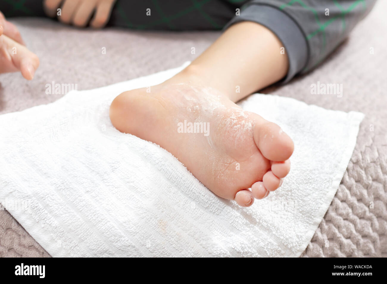 Children's foot sprinkled with white powder lies on a white towel