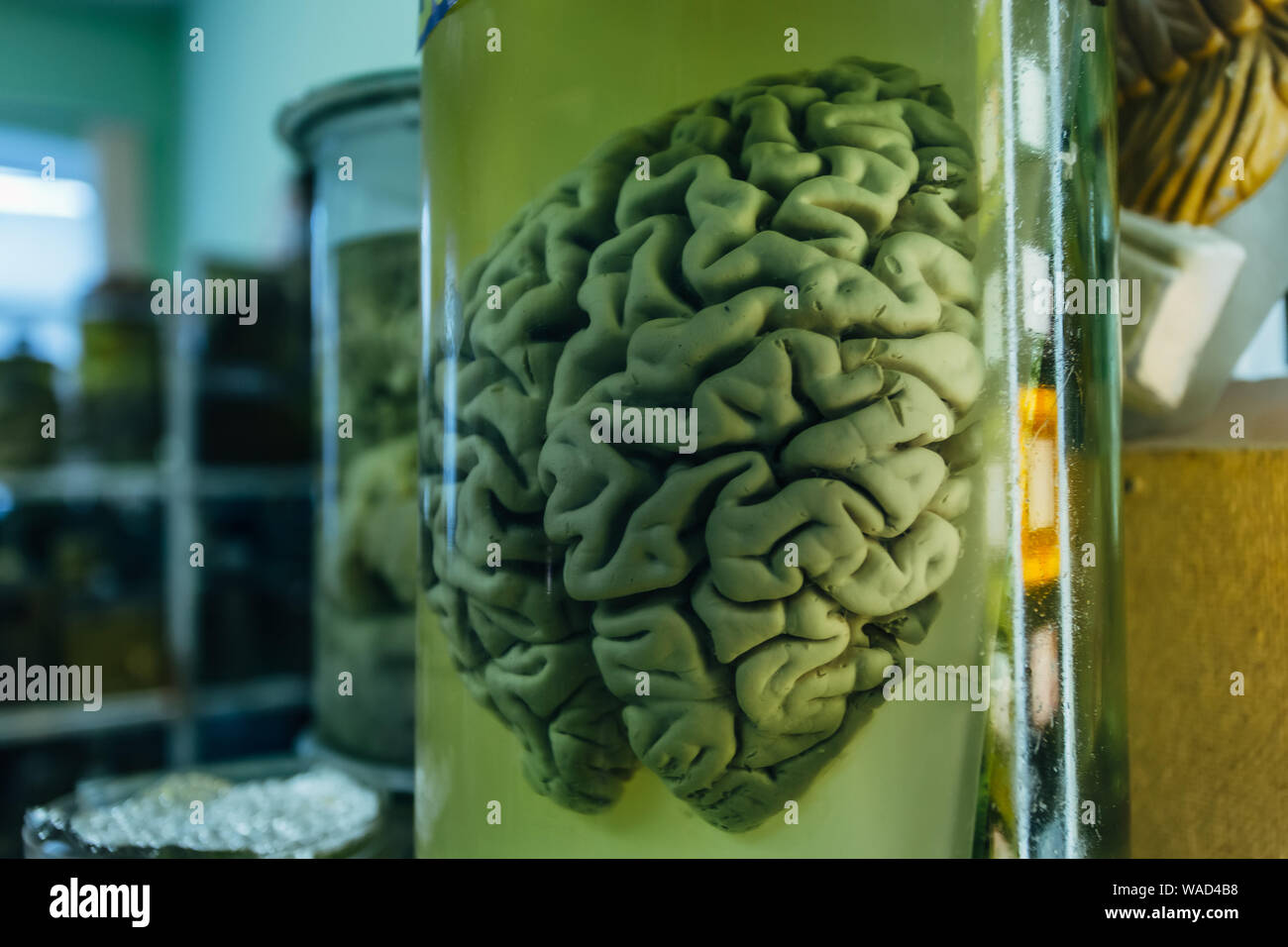 Human brain in glass jar with formaldehyde for medical studies. Stock Photo