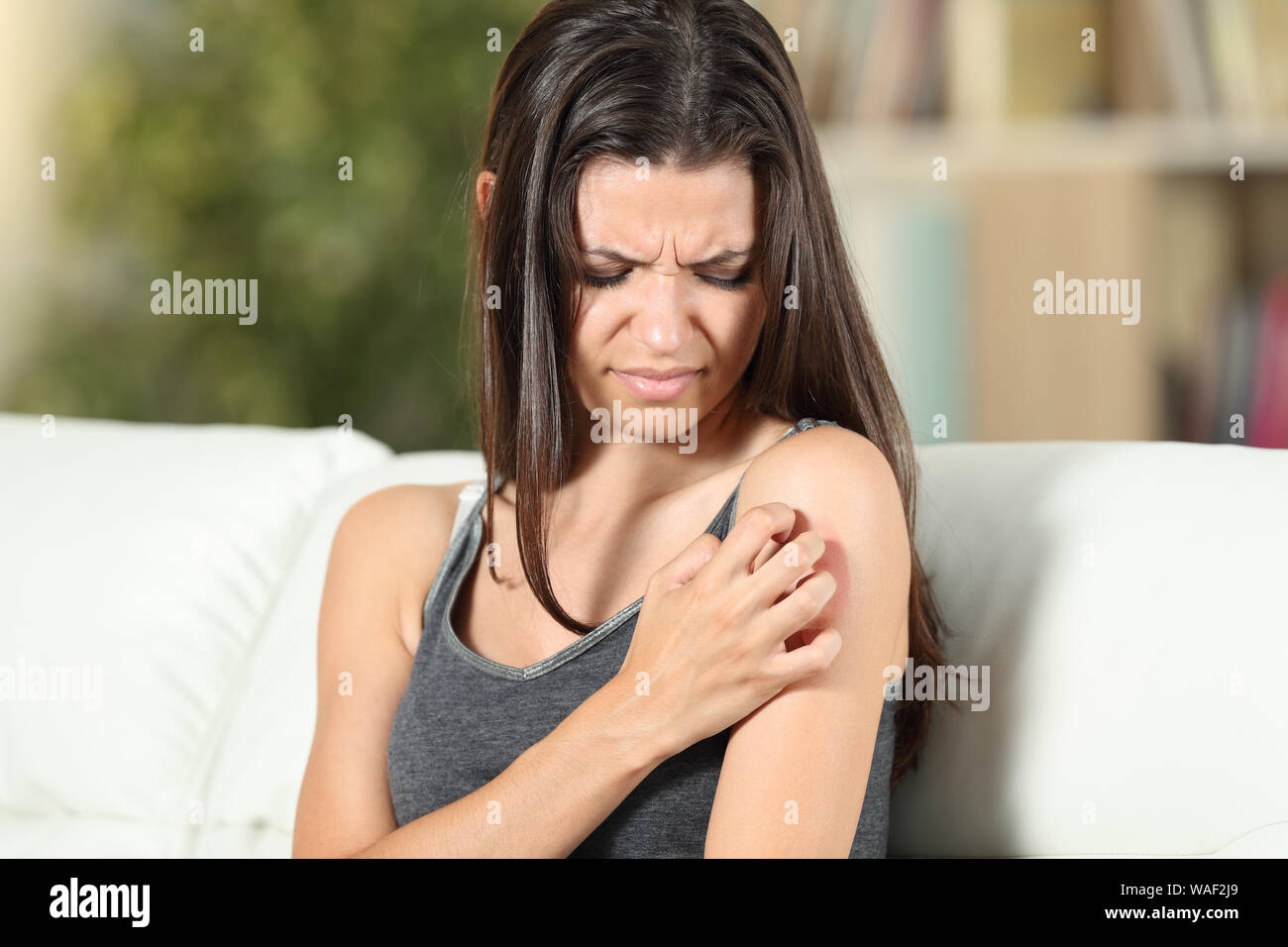 Girl suffering skin irritation scratching arm sitting on a couch in the living room at home Stock Photo