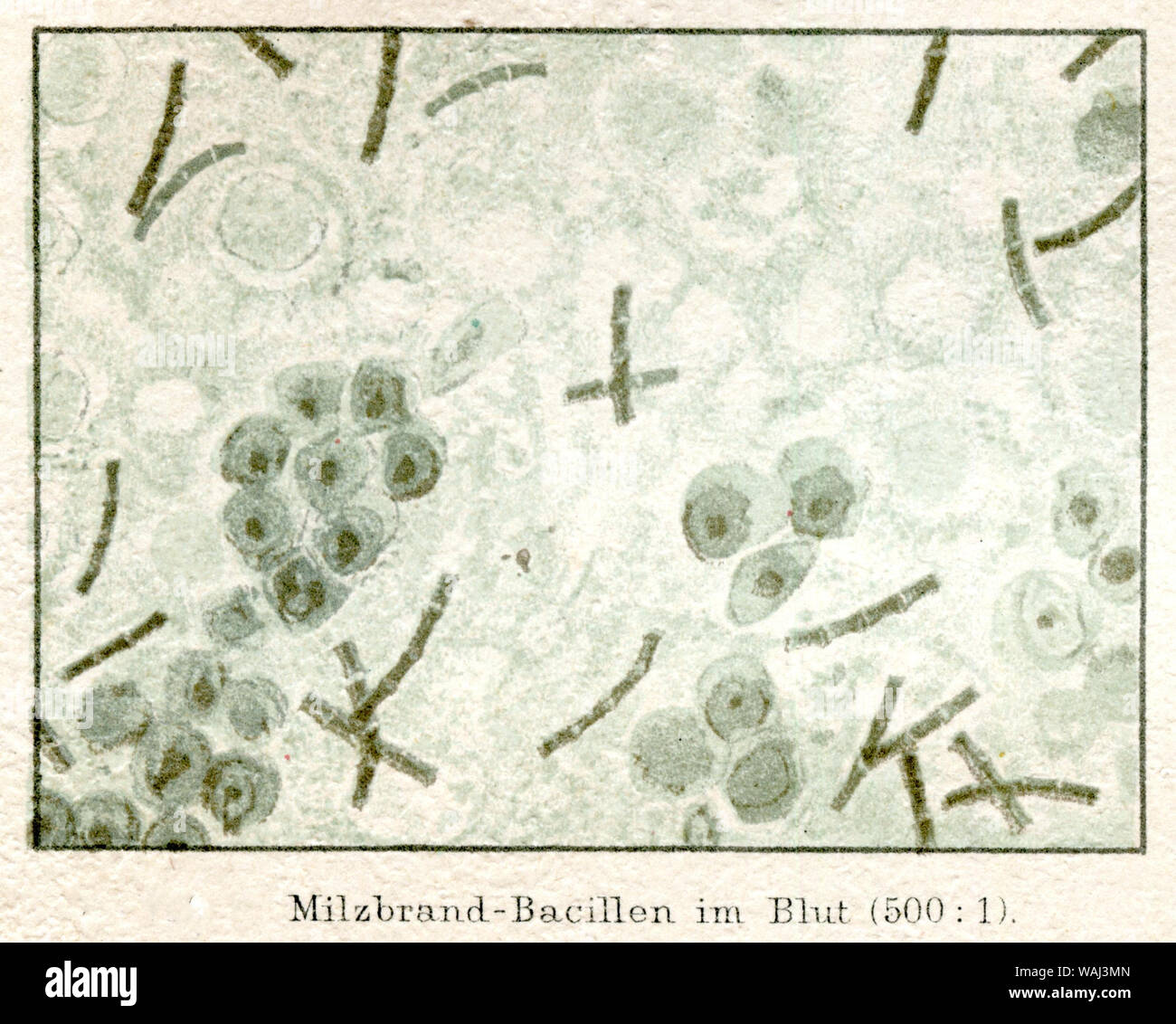 Anthrax bacteria in the blood of a patient under the microscope (500:1). ,  (encyclopedia, 1885) Stock Photo