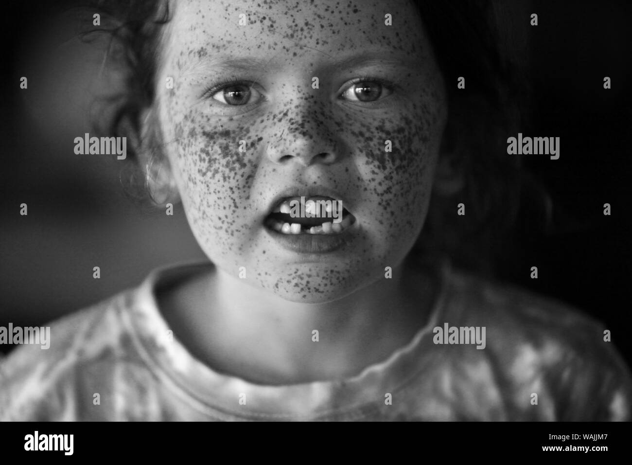A beautiful girl with missing teeth and freckles. Stock Photo