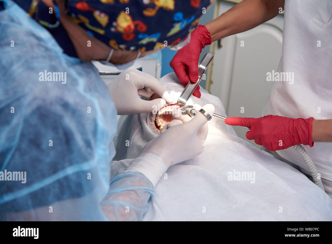 Surgery in the dental clinic.Anesthetic in dental surgery Stock Photo