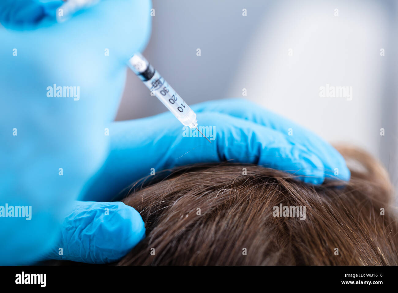 Doctor Giving Injection To His Patient For Hair Fall Stock Photo