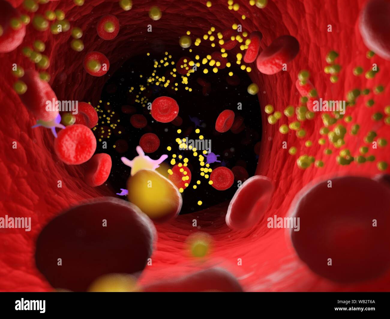 Fat in blood vessels, computer illustration. Stock Photo
