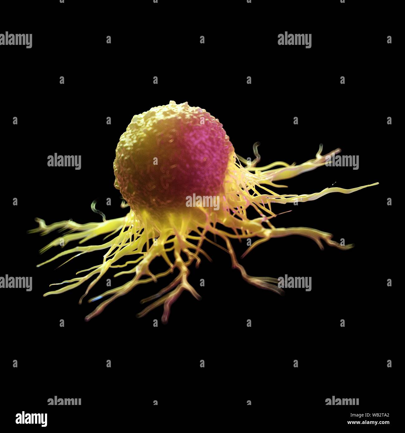 Cancer cell, computer illustration Stock Photo - Alamy
