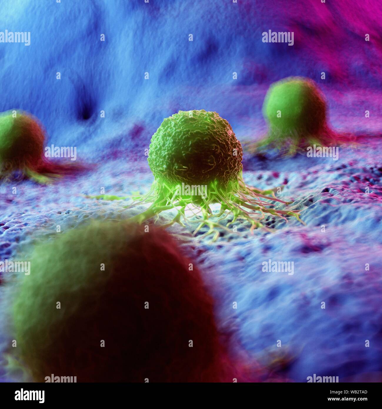 Cancer cells, computer illustration Stock Photo - Alamy