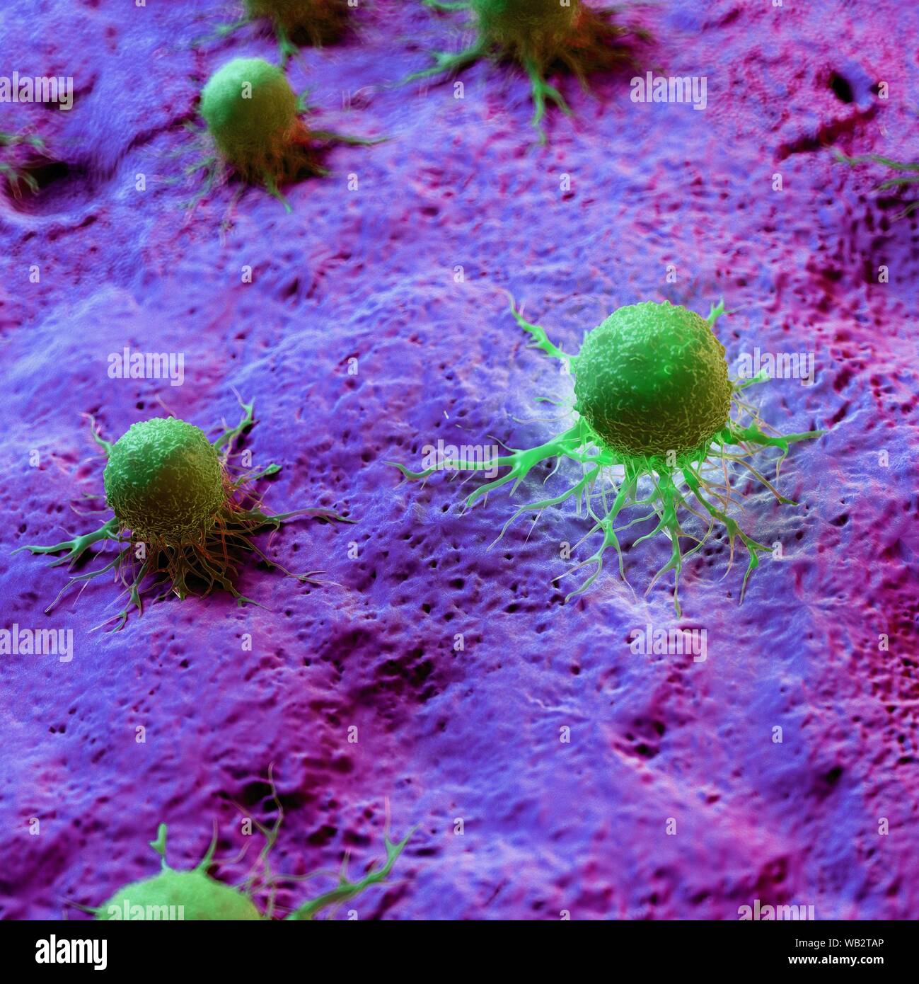 Cancer cells, computer illustration Stock Photo - Alamy