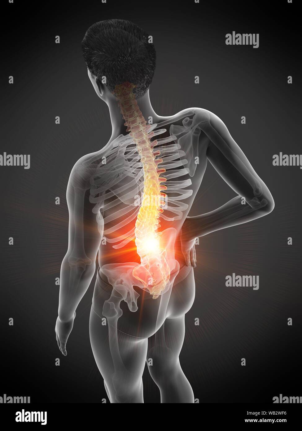 Back pain, conceptual illustration Stock Photo - Alamy