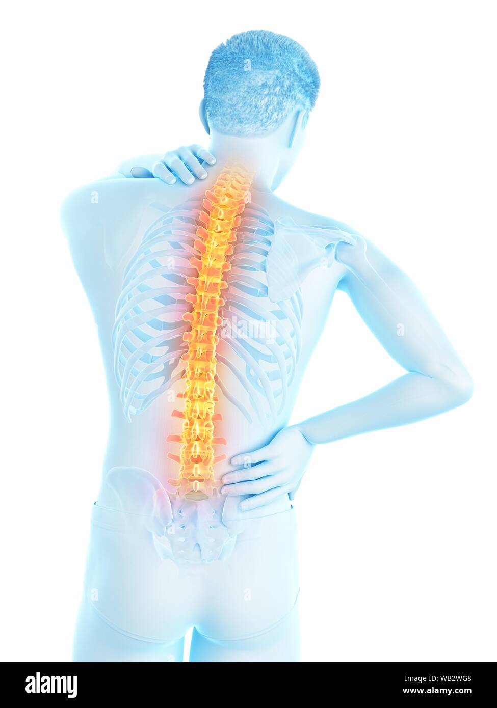 Back pain, conceptual illustration Stock Photo - Alamy