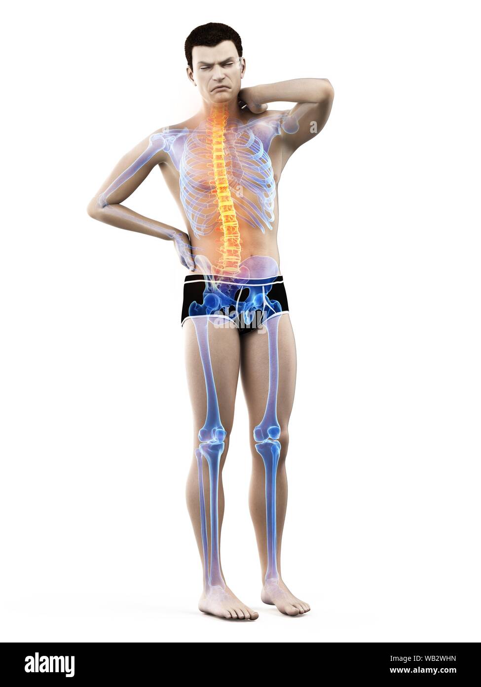 Back pain, conceptual illustration Stock Photo - Alamy