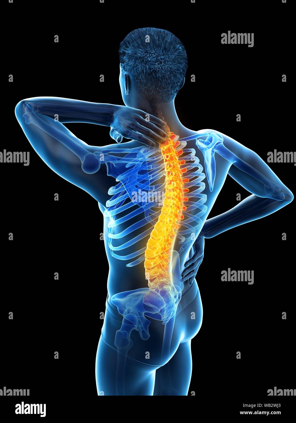 Back pain, conceptual illustration Stock Photo - Alamy