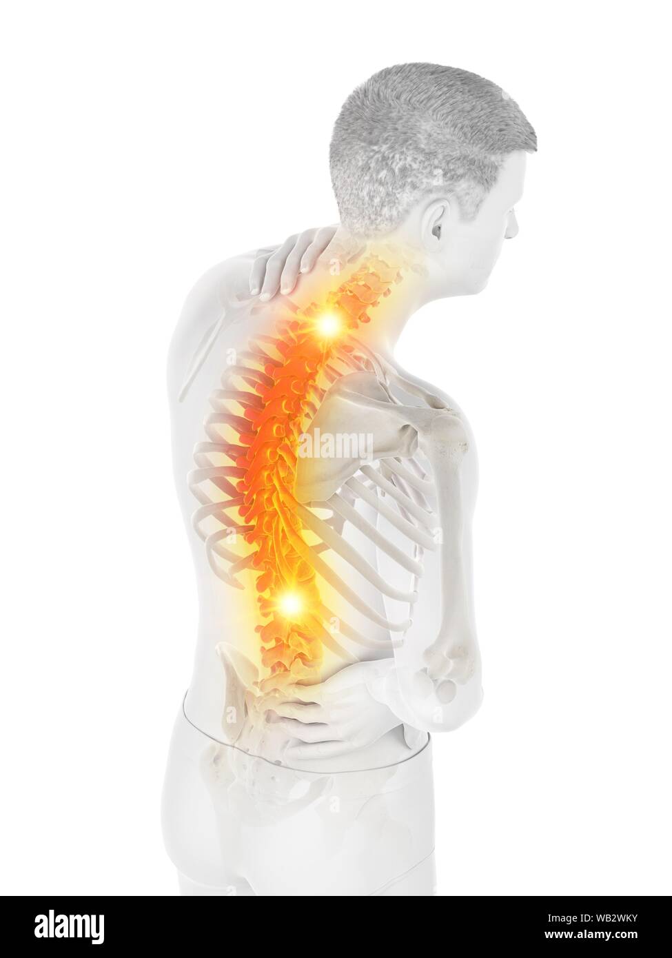 Back pain, conceptual illustration Stock Photo - Alamy