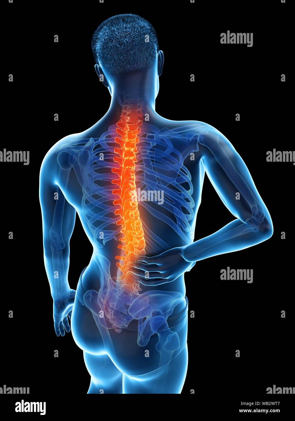 Back pain, conceptual illustration Stock Photo - Alamy