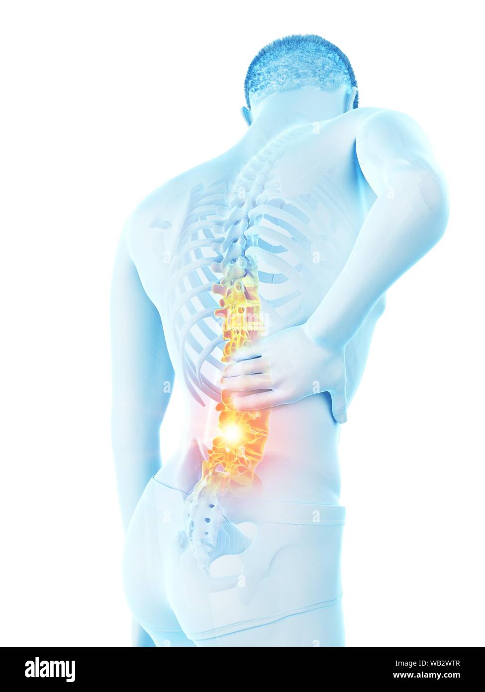 Back pain, conceptual illustration Stock Photo - Alamy