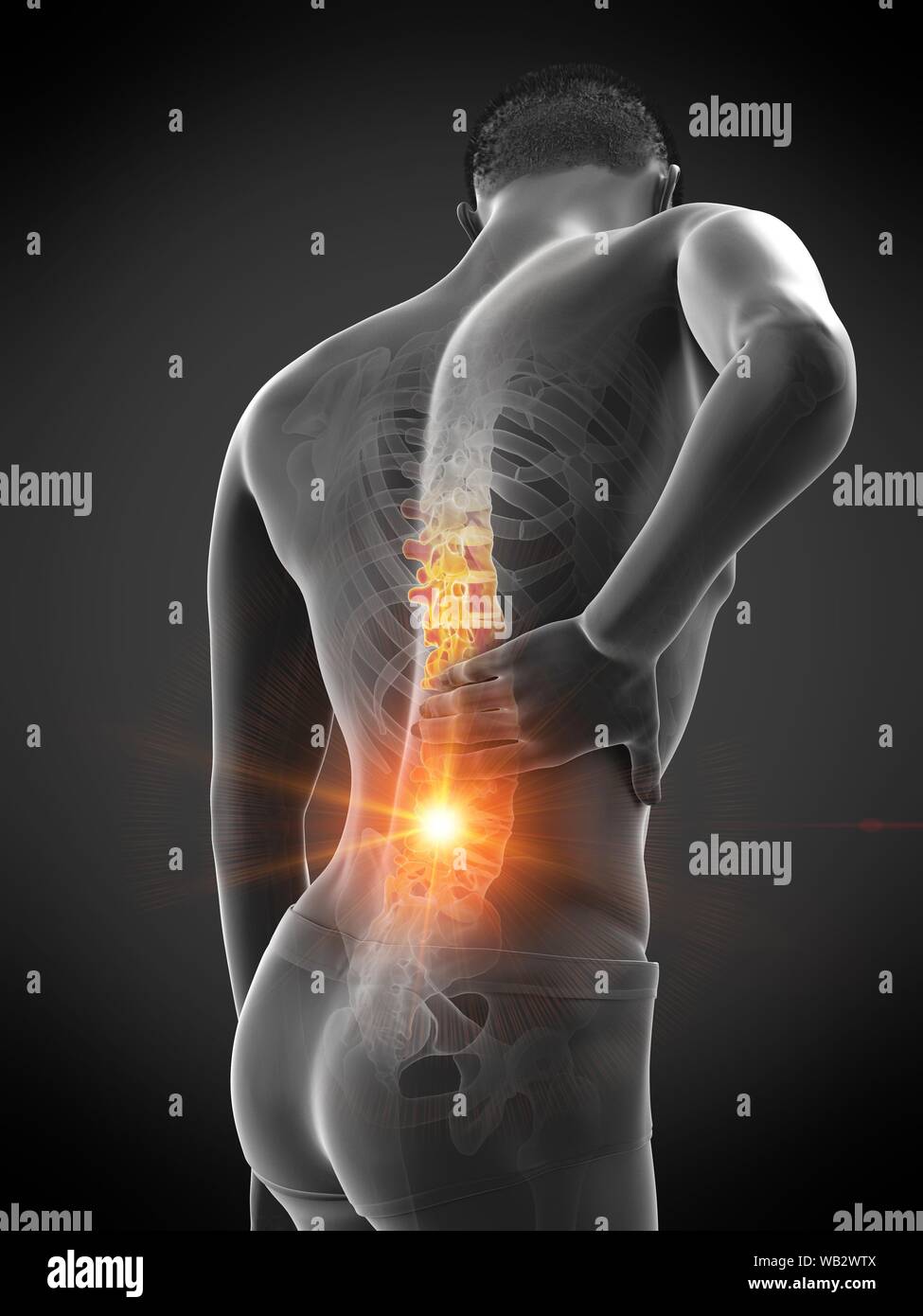 Back pain, conceptual illustration Stock Photo - Alamy