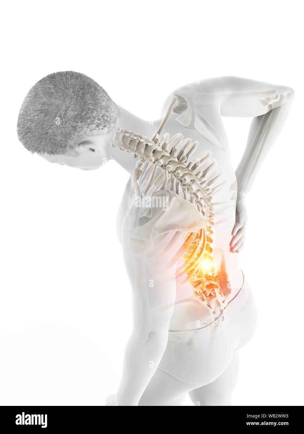 Back pain, conceptual illustration Stock Photo - Alamy