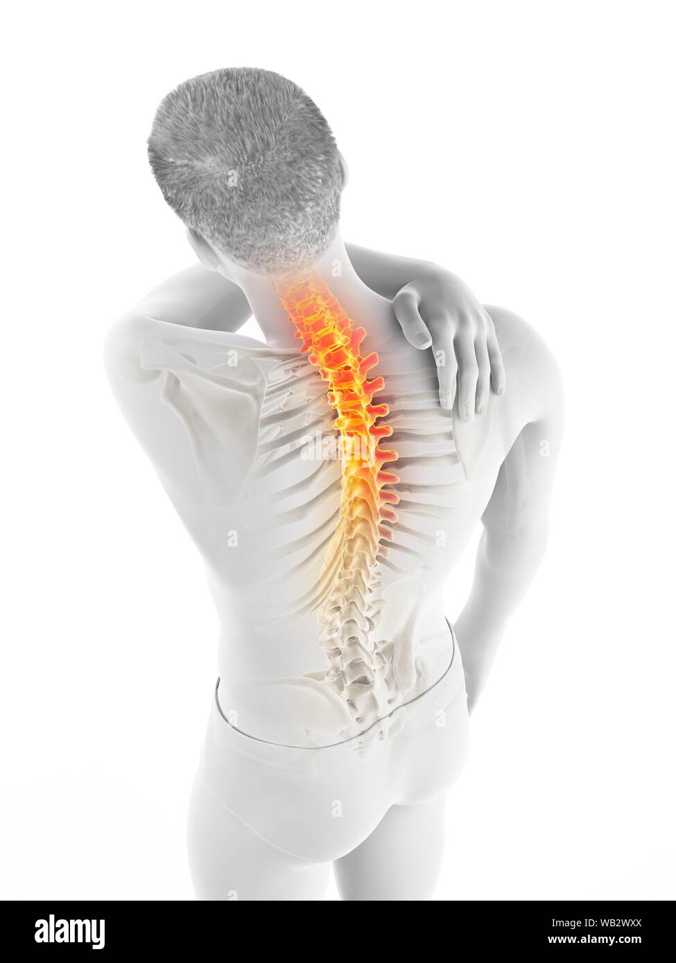 Back pain, conceptual illustration Stock Photo - Alamy