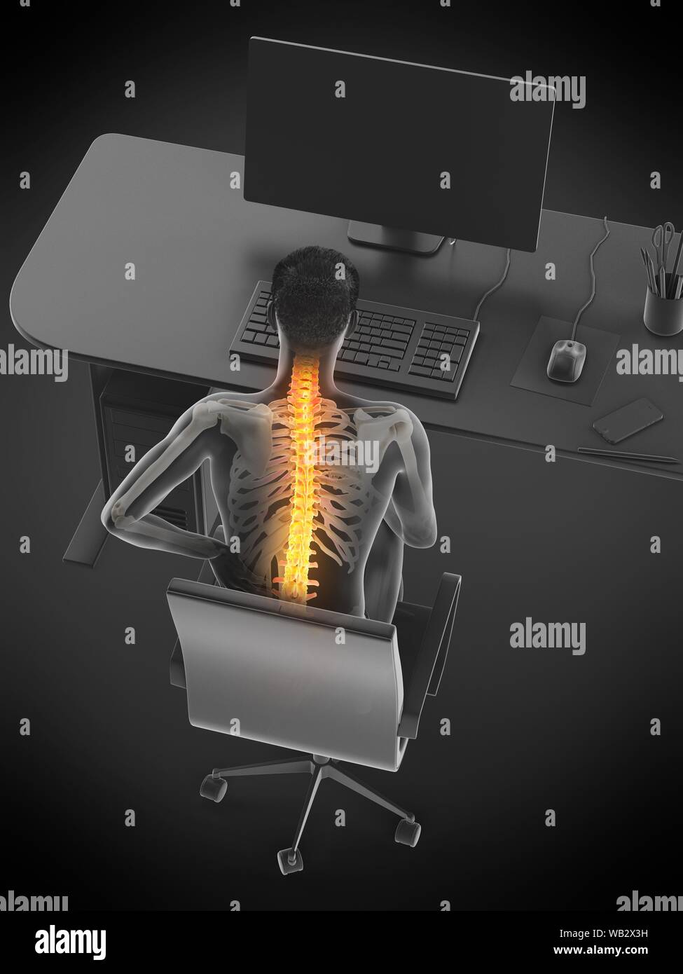 Back pain due to sitting, conceptual illustration Stock Photo Alamy