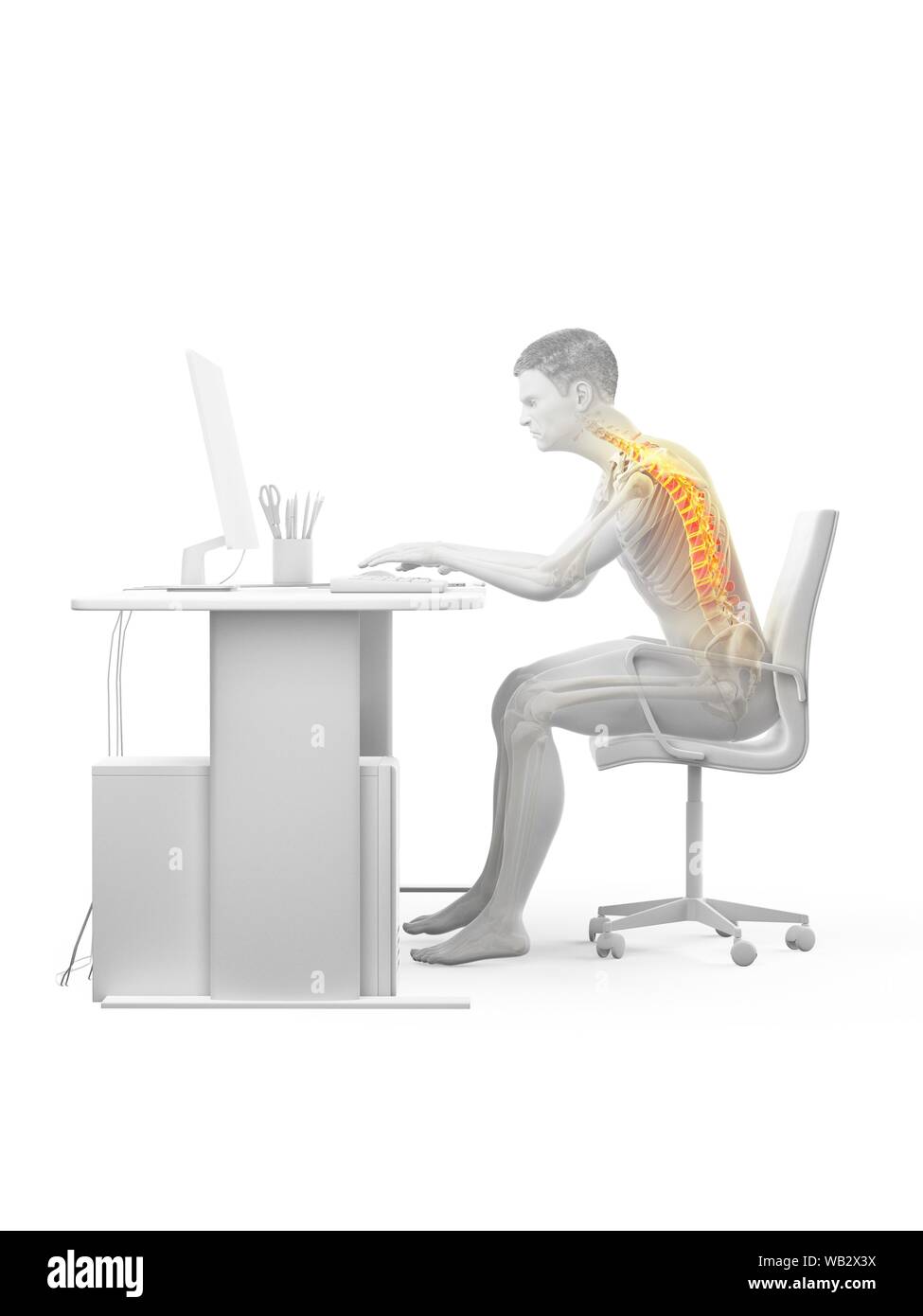 Back pain due to sitting, conceptual illustration Stock Photo - Alamy