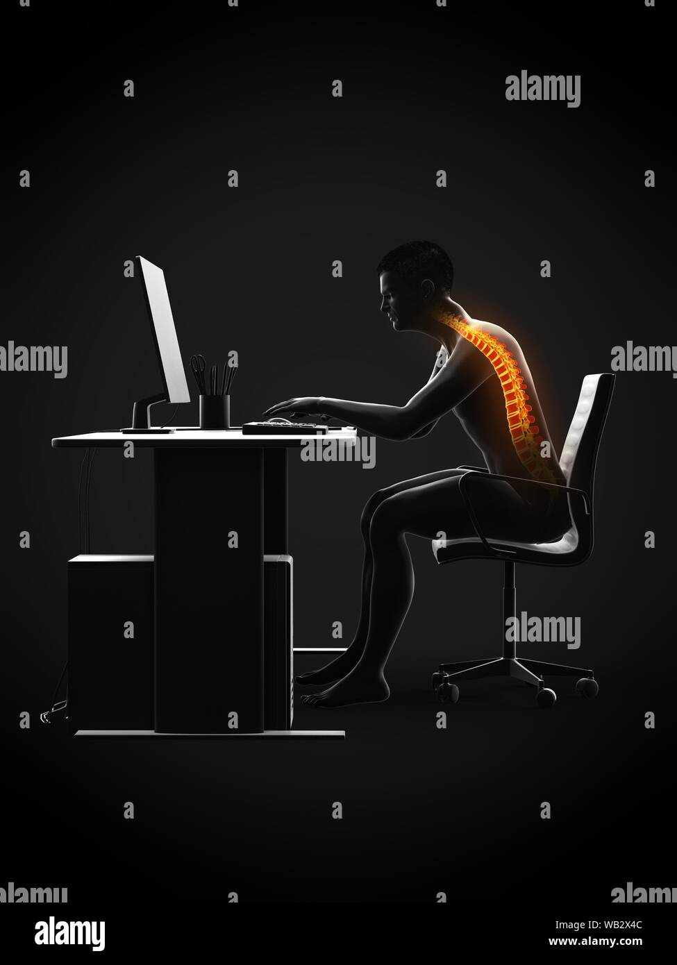 Back pain due to sitting, conceptual illustration Stock Photo Alamy
