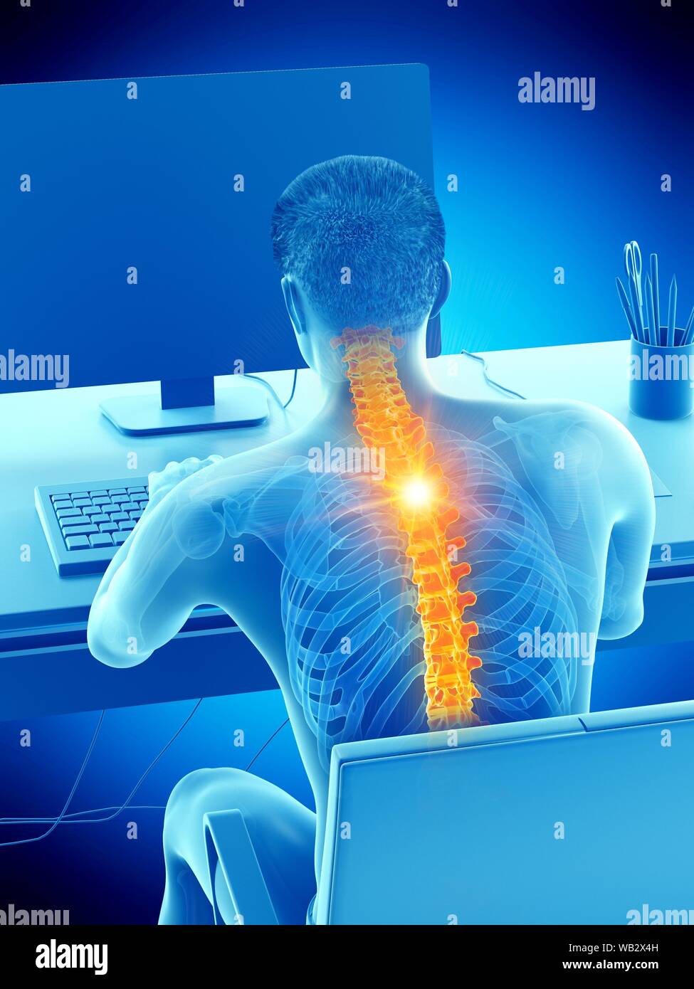 Back pain due to sitting, conceptual illustration Stock Photo - Alamy