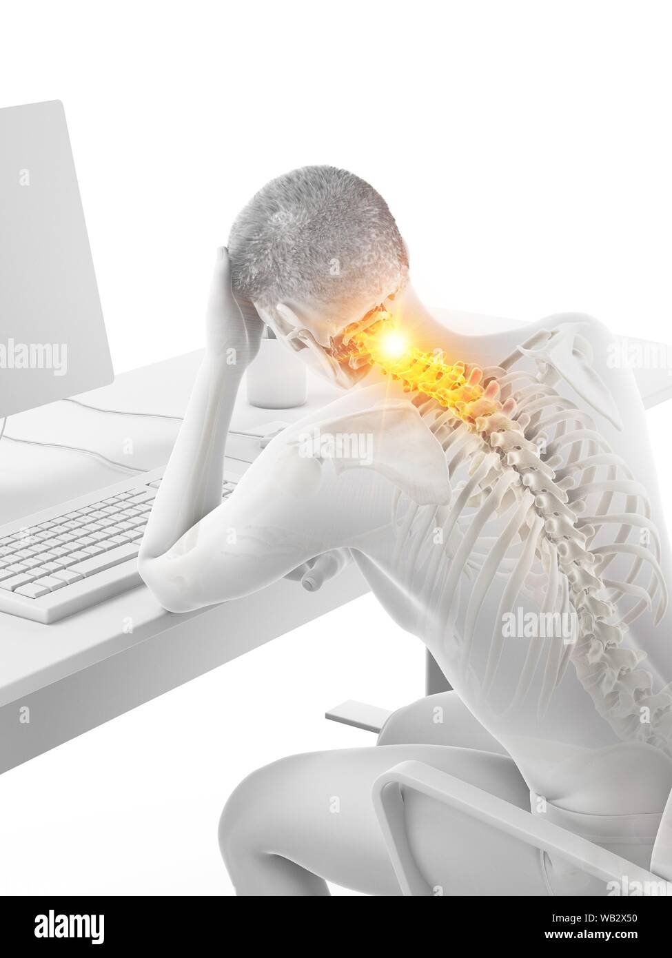 Picture Idea: Office Worker With Neck Pain Conceptual Illustration Stock Photo