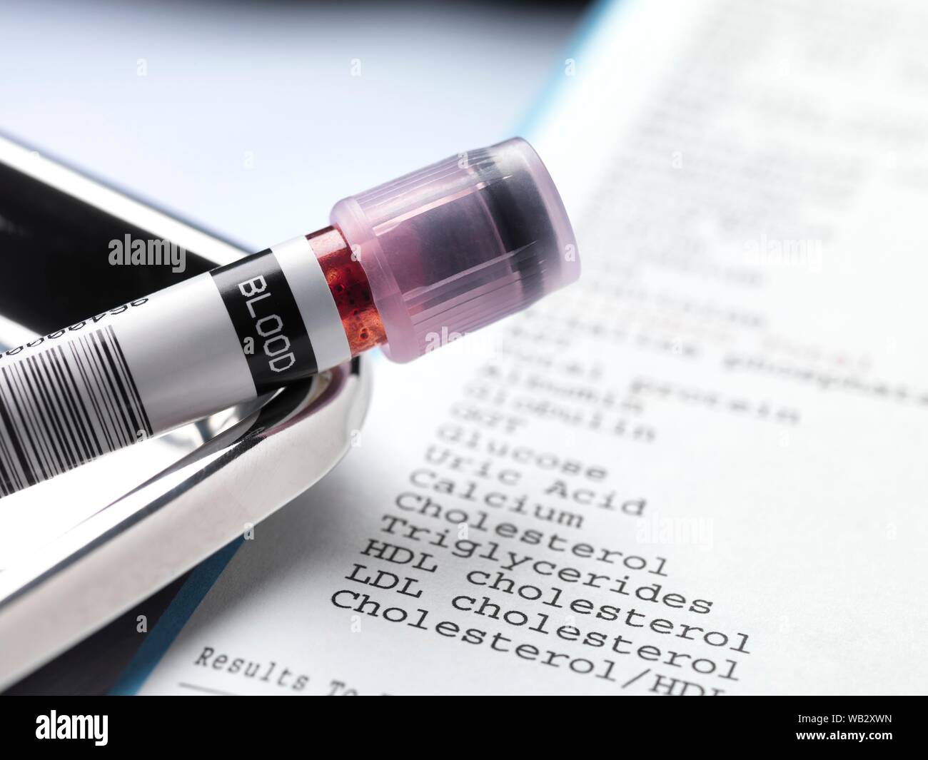 Blood sample and test results. Stock Photo