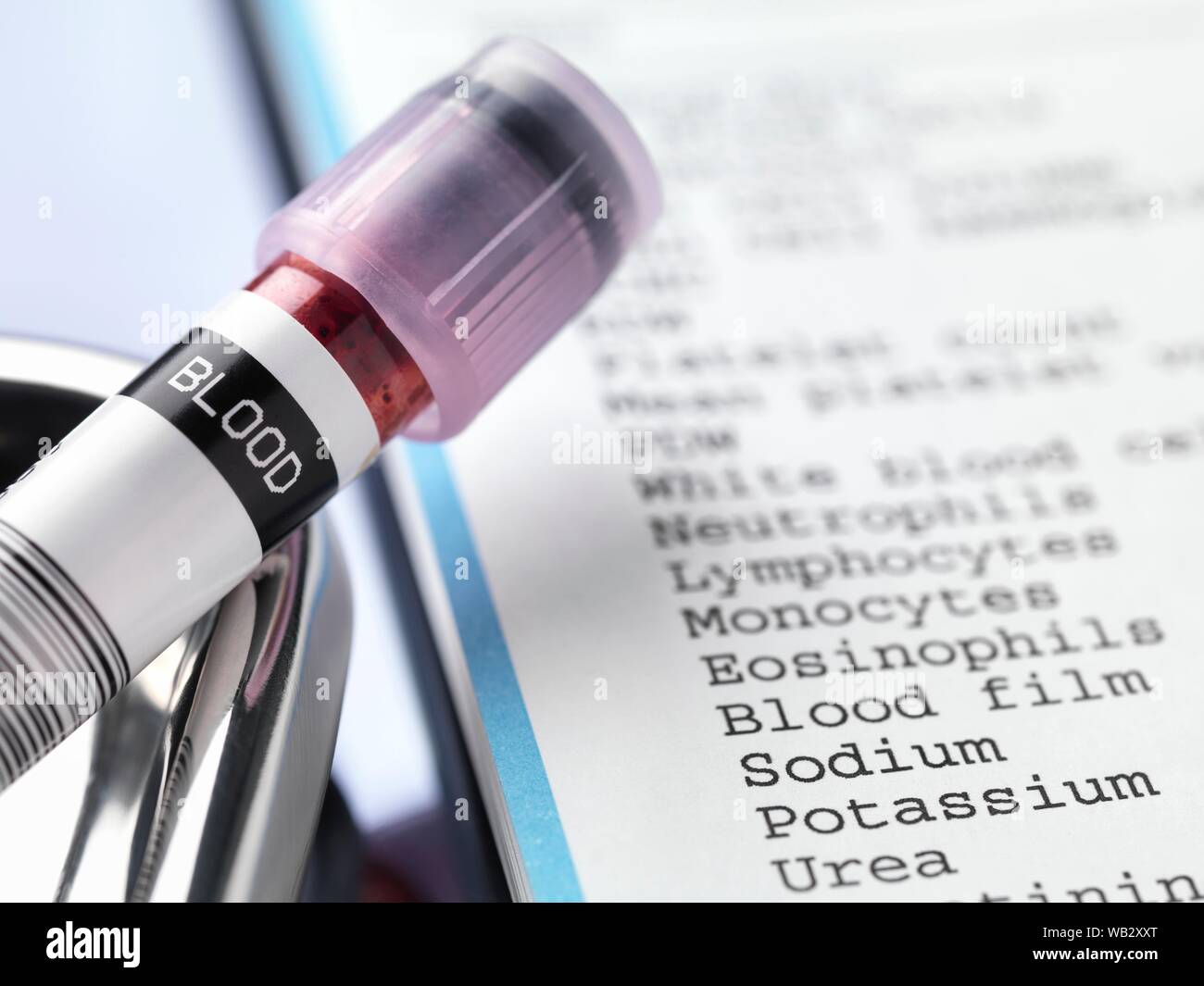 Blood sample and test results Stock Photo Alamy