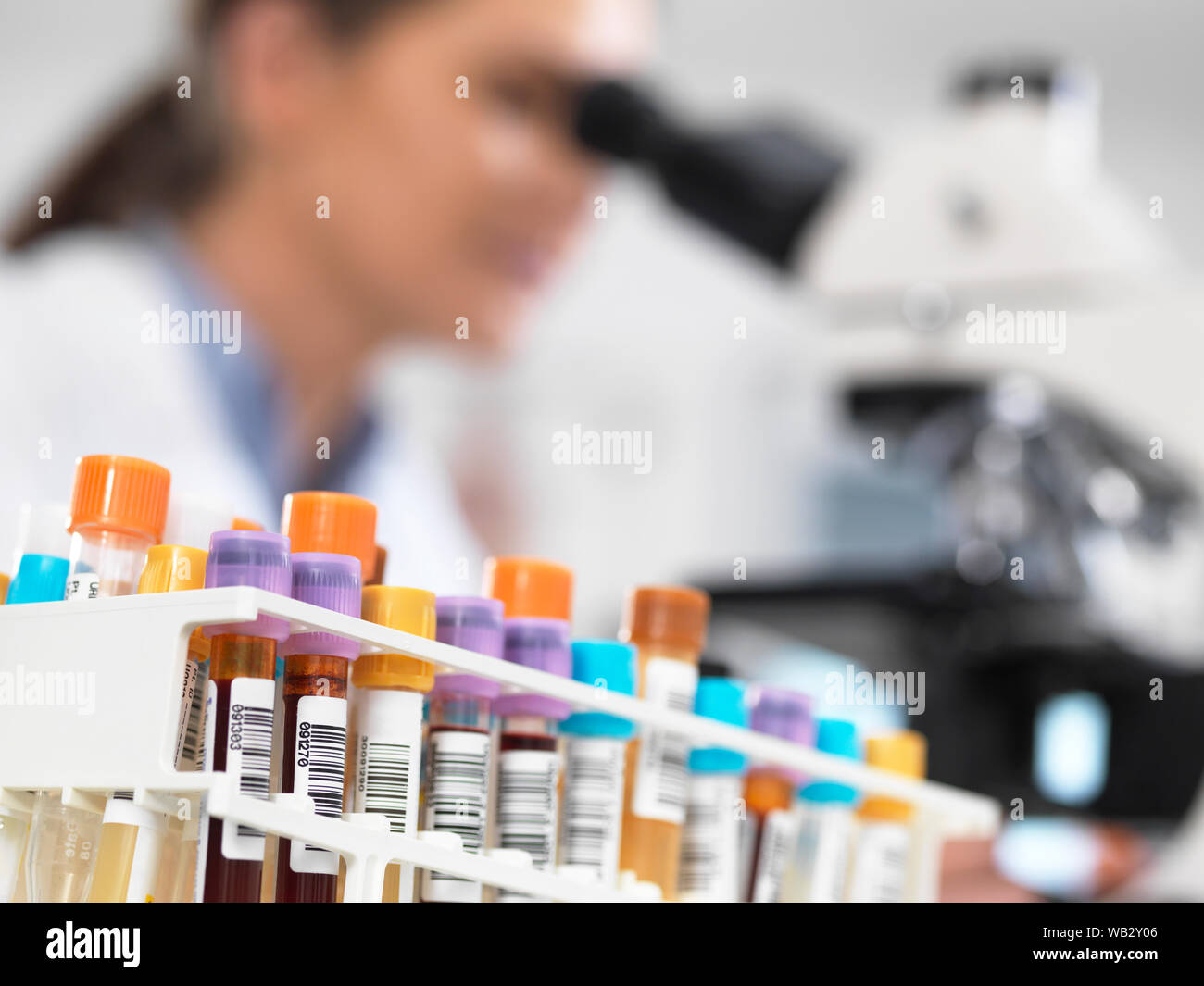 Medical screening. Scientist examining a glass slide containing a human sample under a microscope. Stock Photo