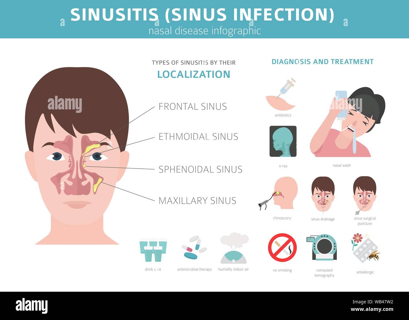 Sinus Infection High Resolution Stock Photography And Images Alamy