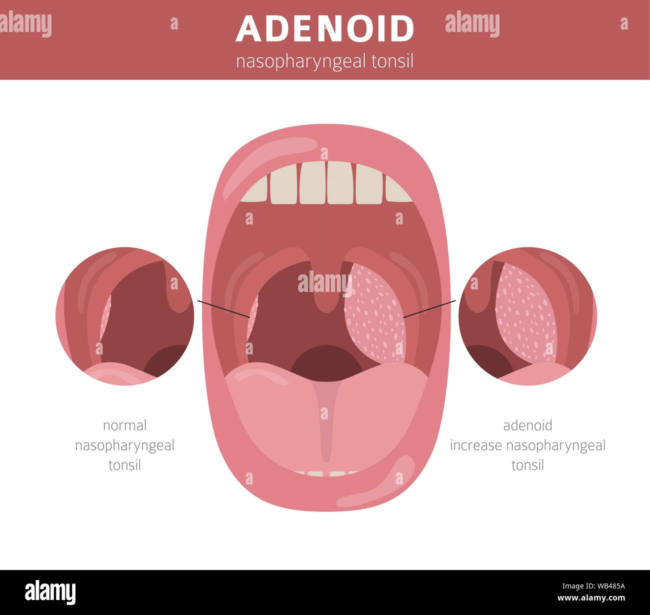 Tonsils And Adenoids Diagram Biology Diagrams