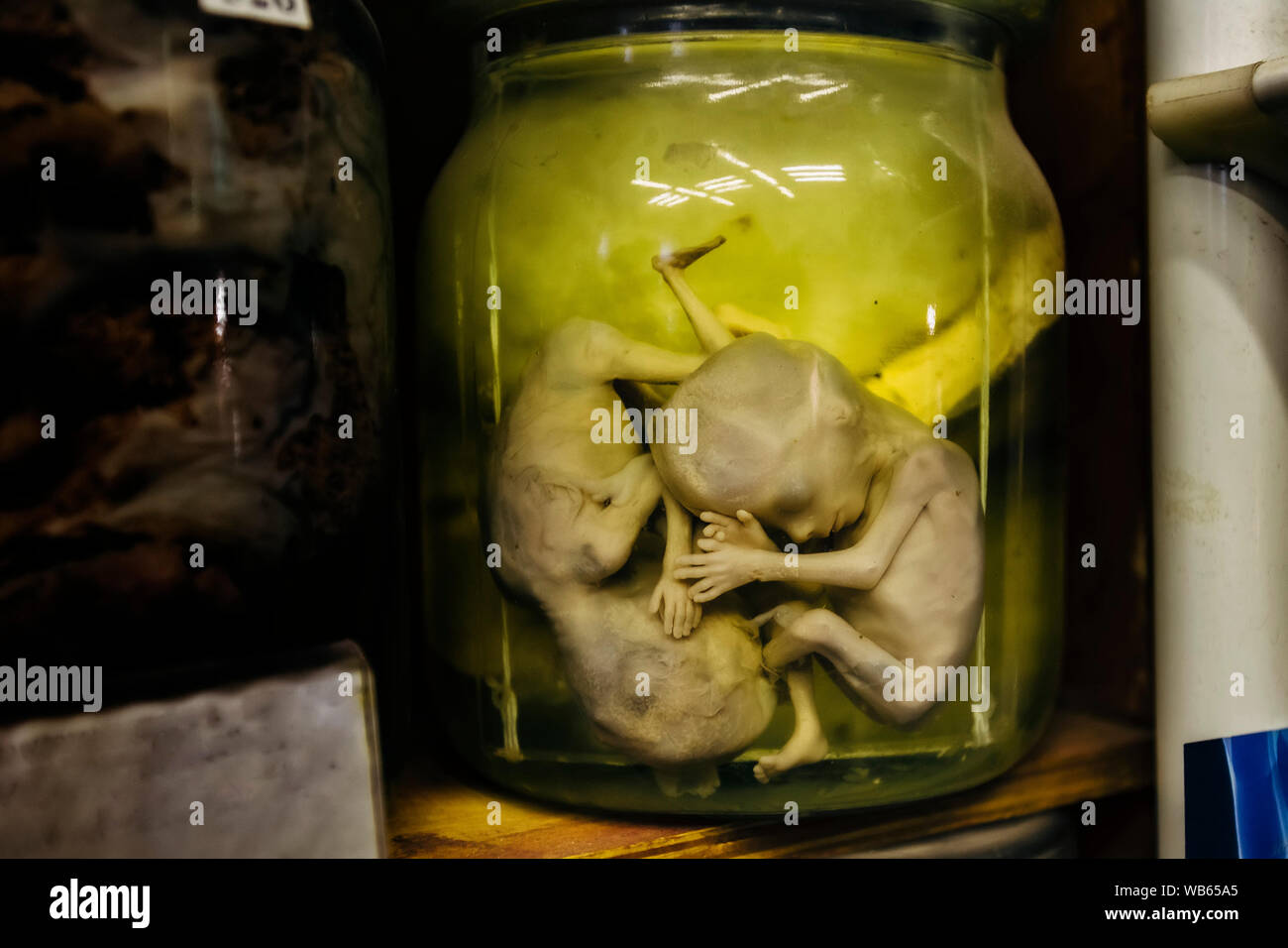 Fetus in formalin hi-res stock photography and images - Alamy