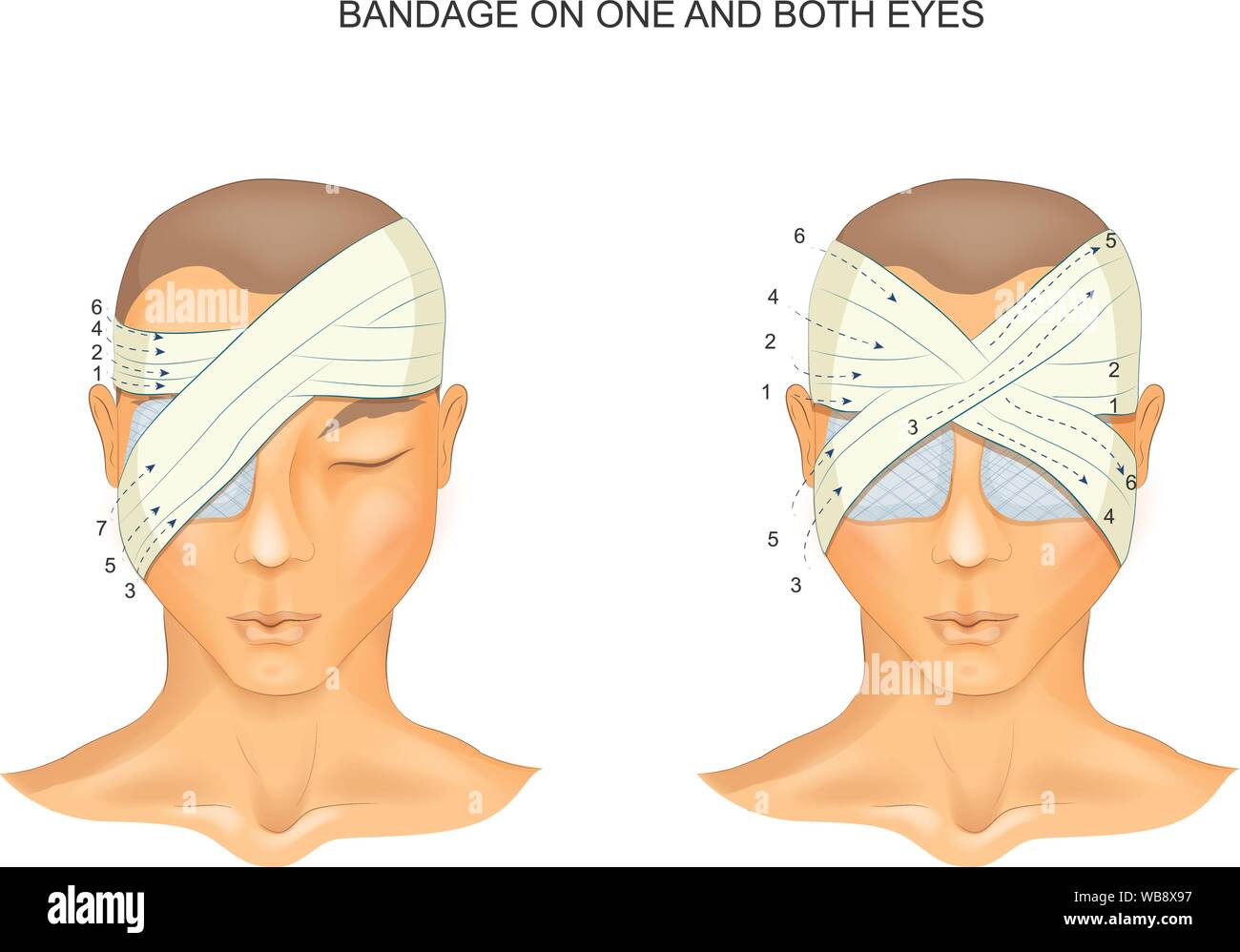 vector illustration of the bandage on one and both eyes Stock Vector
