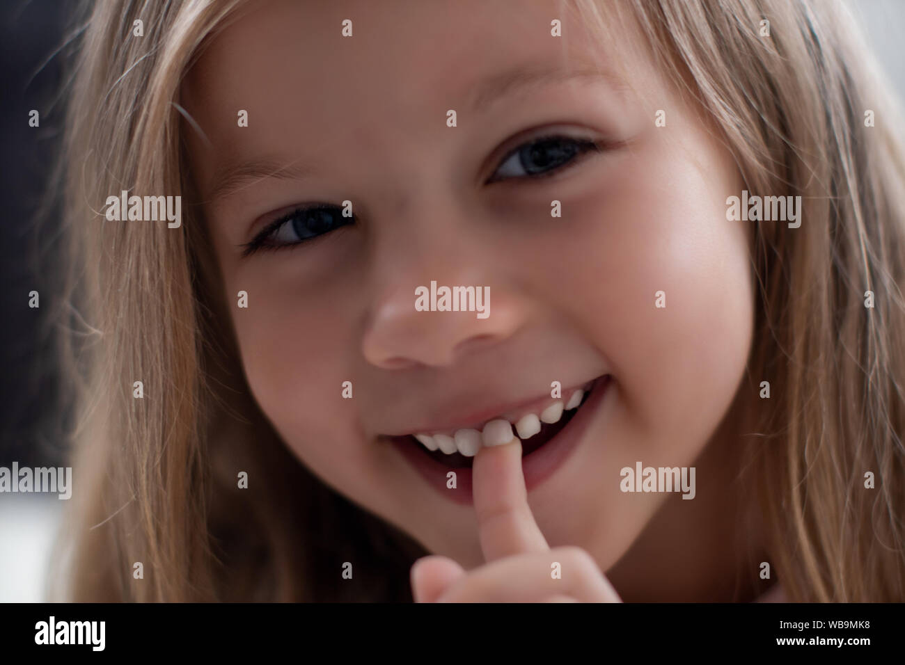 Blue-eyed blond girl laughs and shows the first tooth. children's teeth, loss Stock Photo