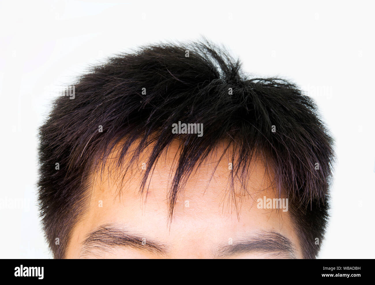 hair loss, Male head with hair loss symptoms front side Stock Photo - Alamy