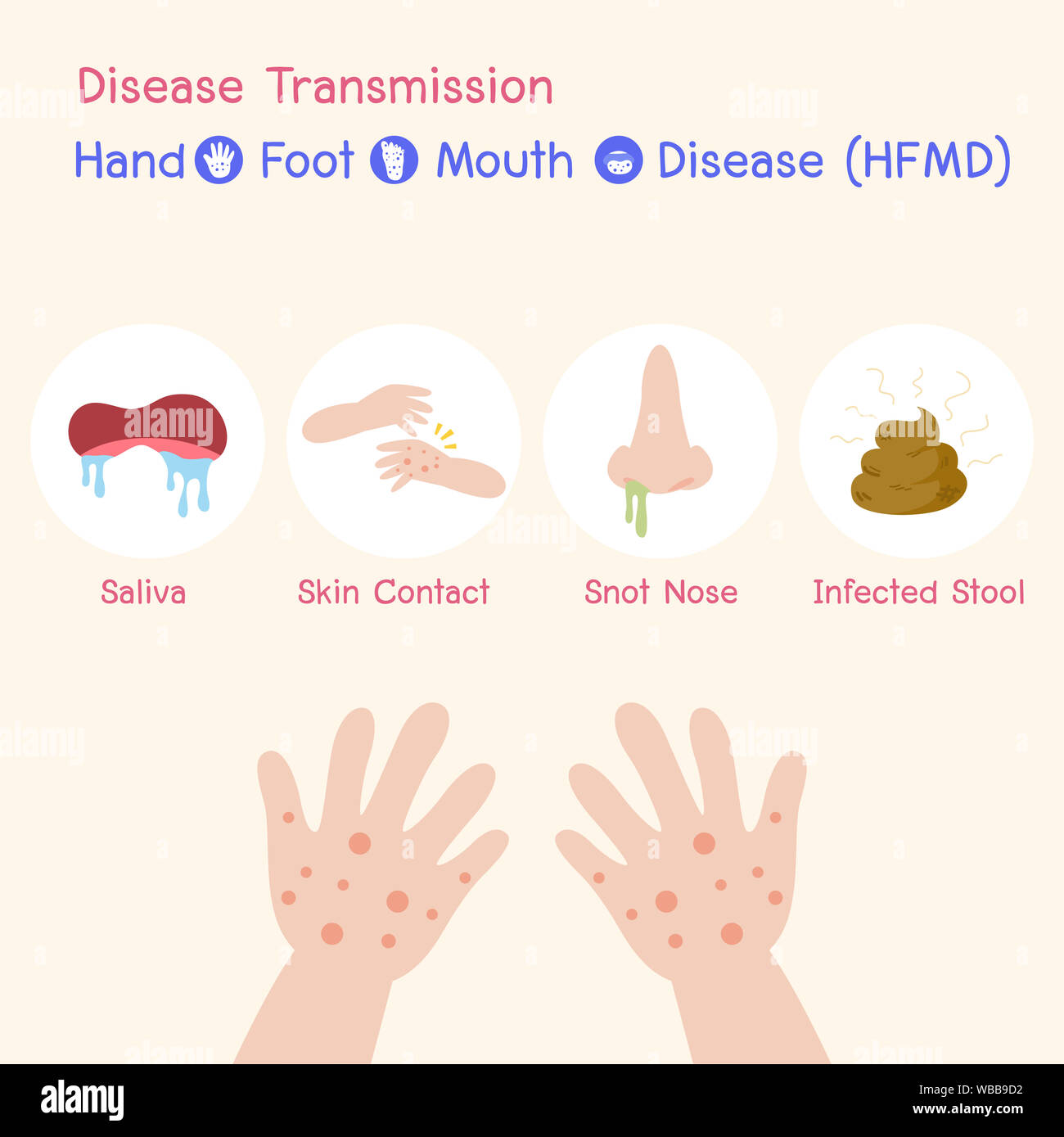 Disease Transmission the Disease virus baby Children infected have a