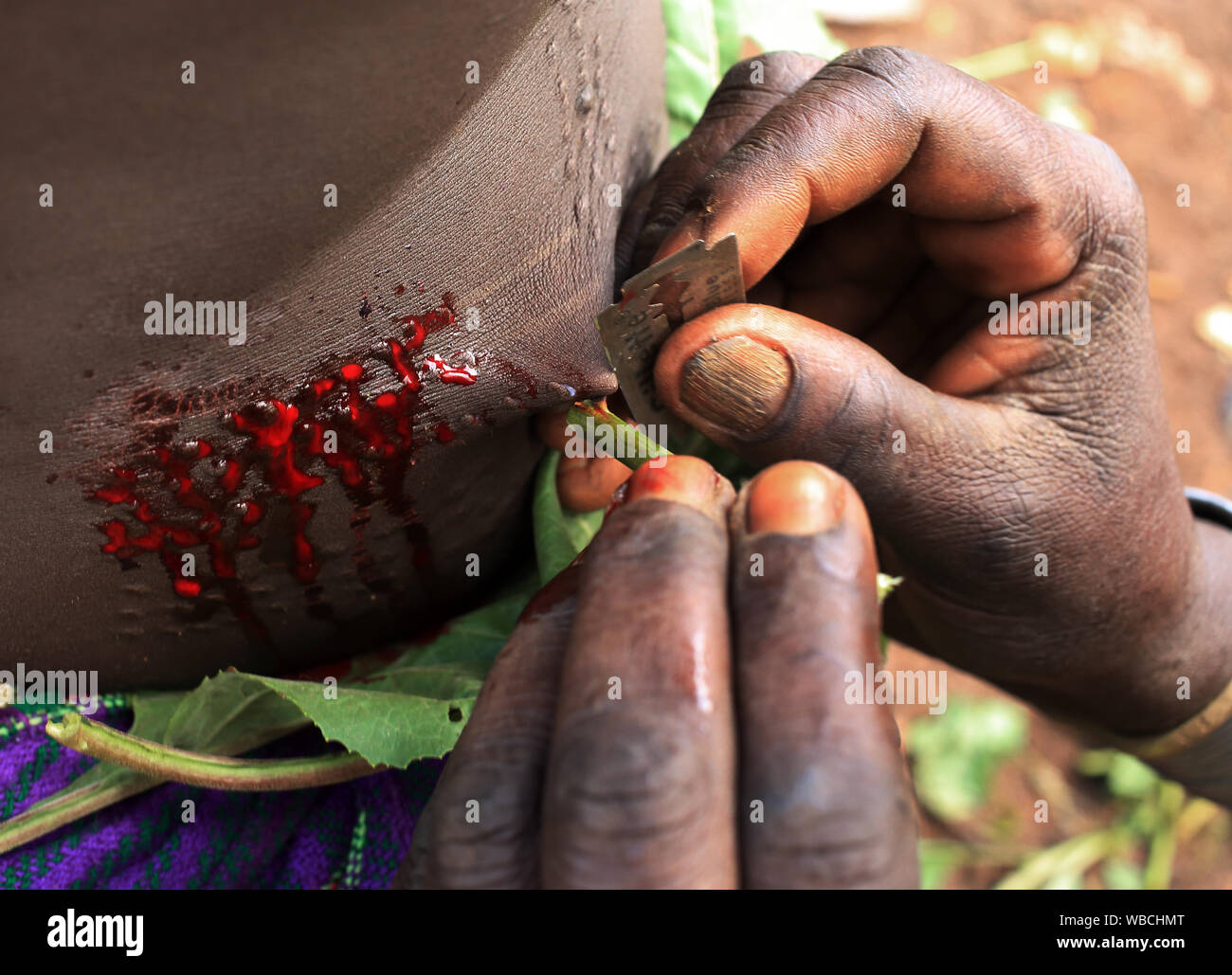 Scarification with razor blade, Suri, Ethiopia Stock Photo