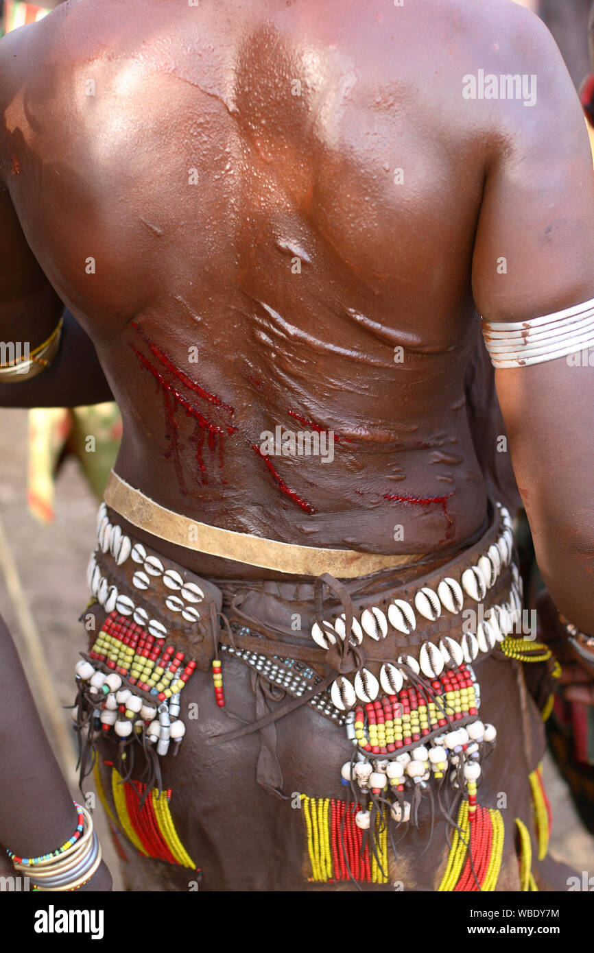 Scarification on upper body, Mursi tribe, Lower Omo Valley, Ethiopia Stock Photo