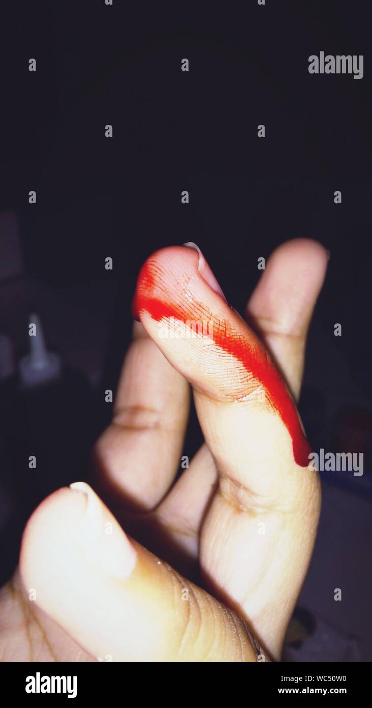 Blood Bleeding Hand High Resolution Stock Photography And Images