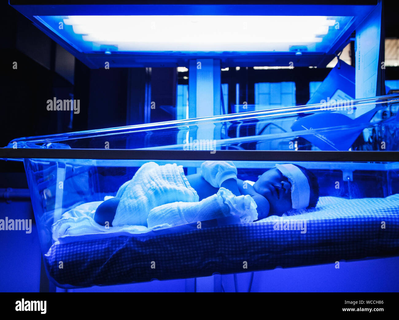 Baby Suffering From Jaundice Lying Under Ultraviolet Light In Incubator  Stock Photo - Alamy