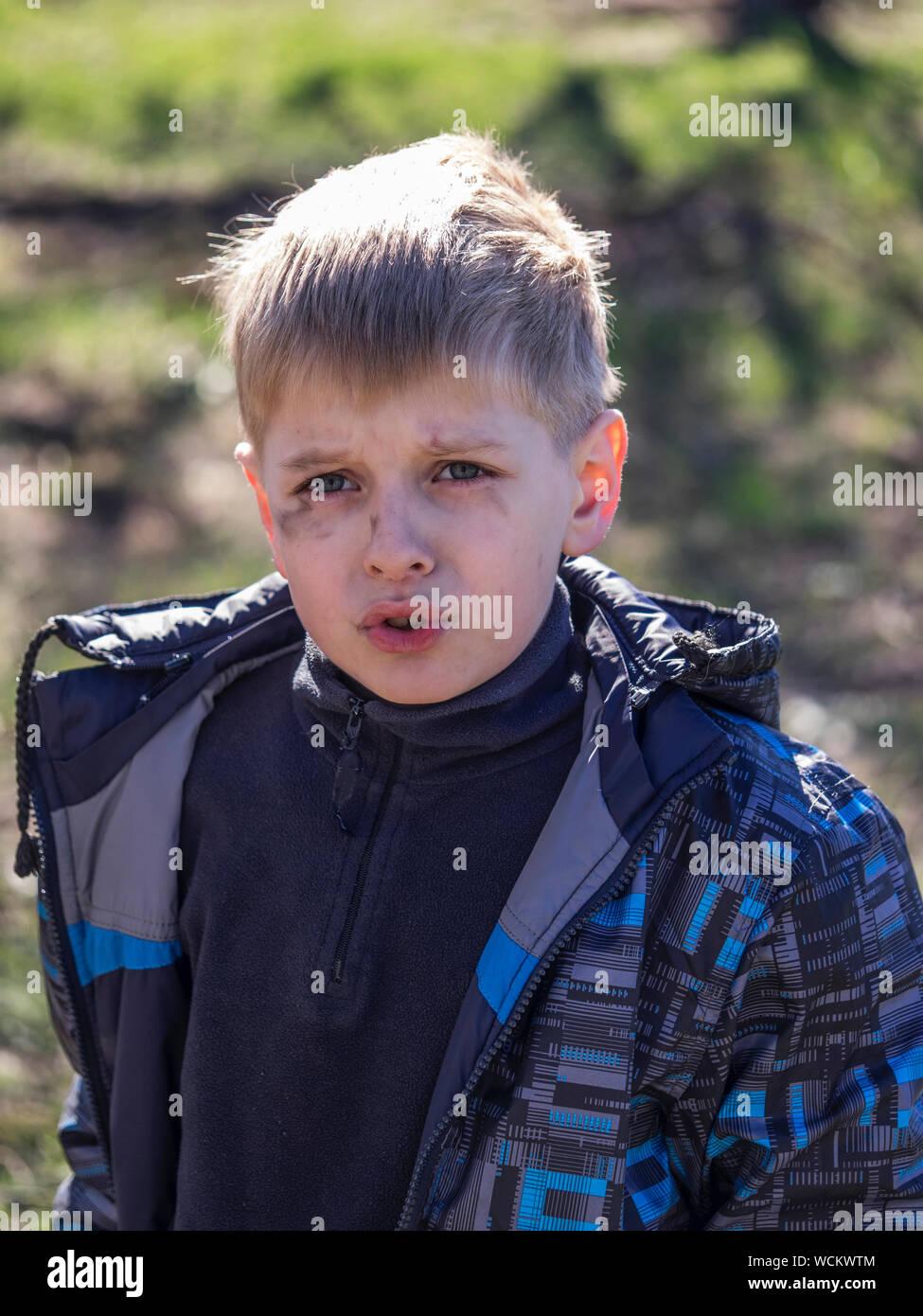 Boy With Soot Smear On Face Stock Photo