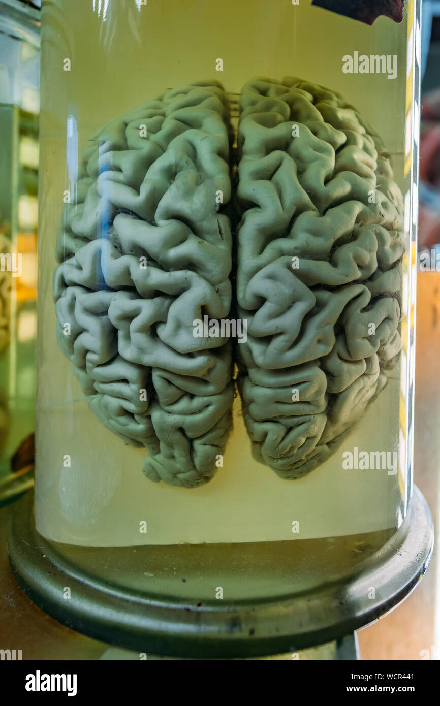 Human brain in glass jar with formaldehyde for medical studies Stock Photo  - Alamy