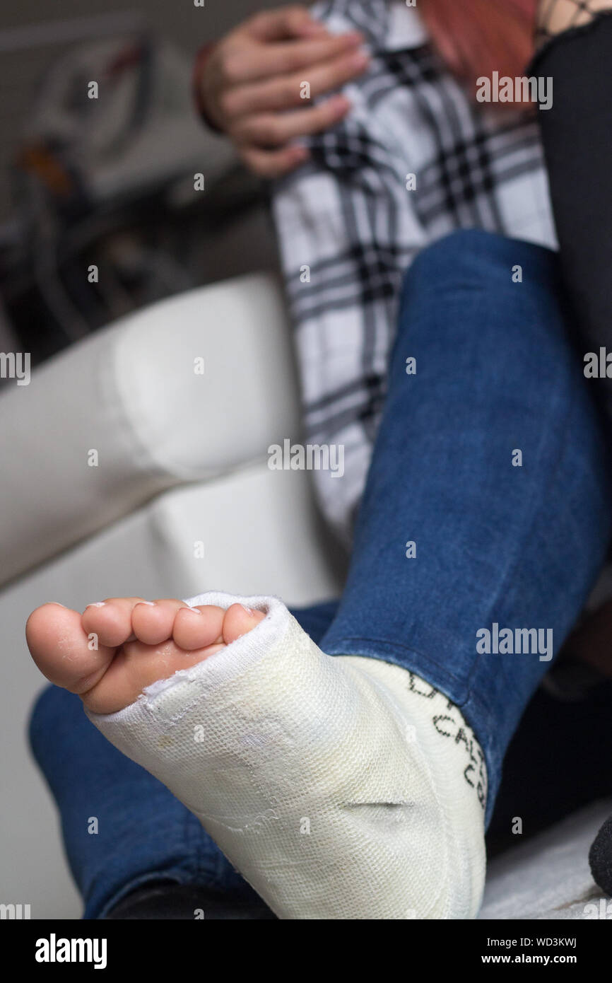 Low Section Of Woman With Fracture Leg Stock Photo