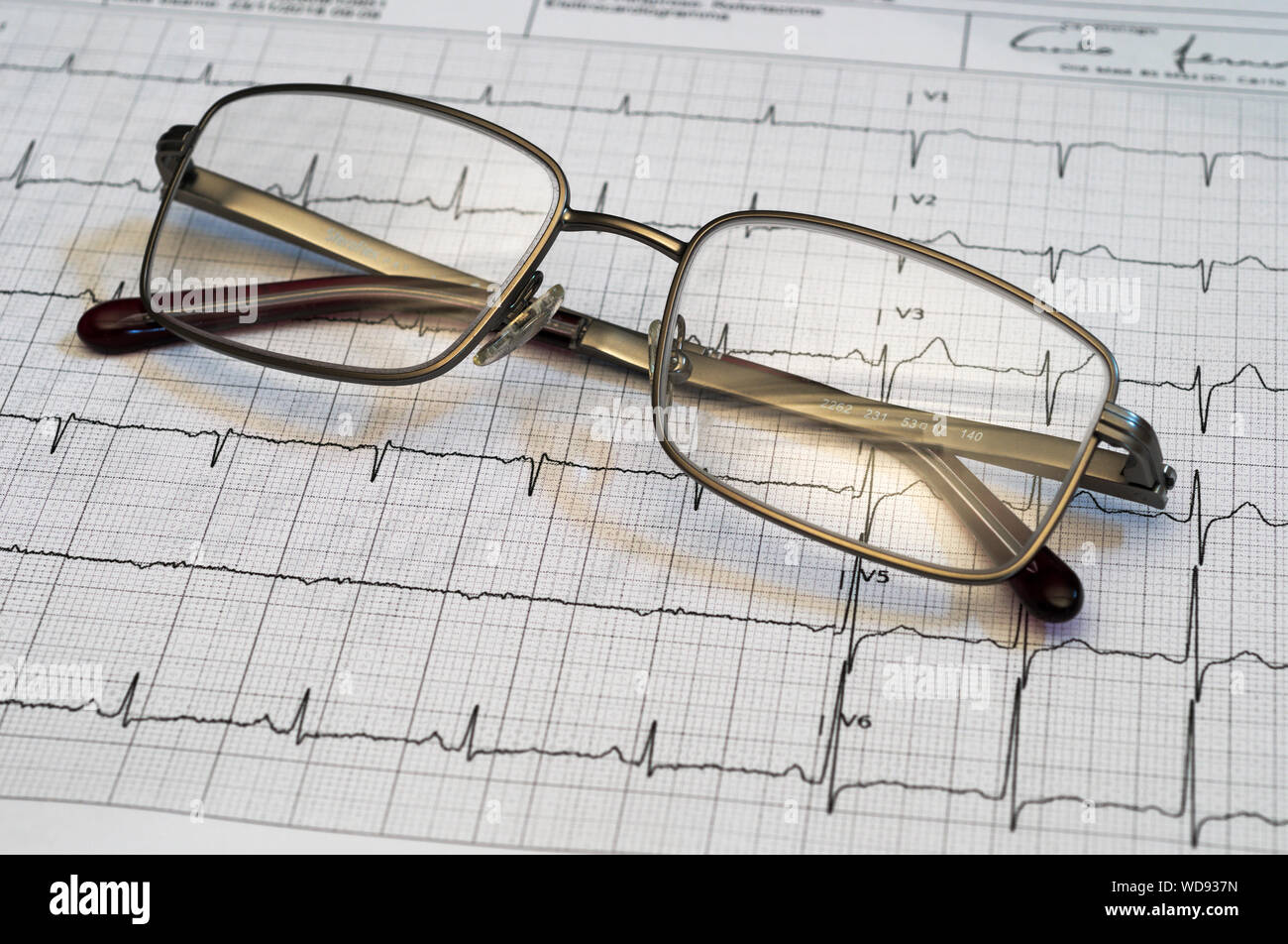 eyeglasses on Electrocardiogram (EKG) heartbeat graph Stock Photo