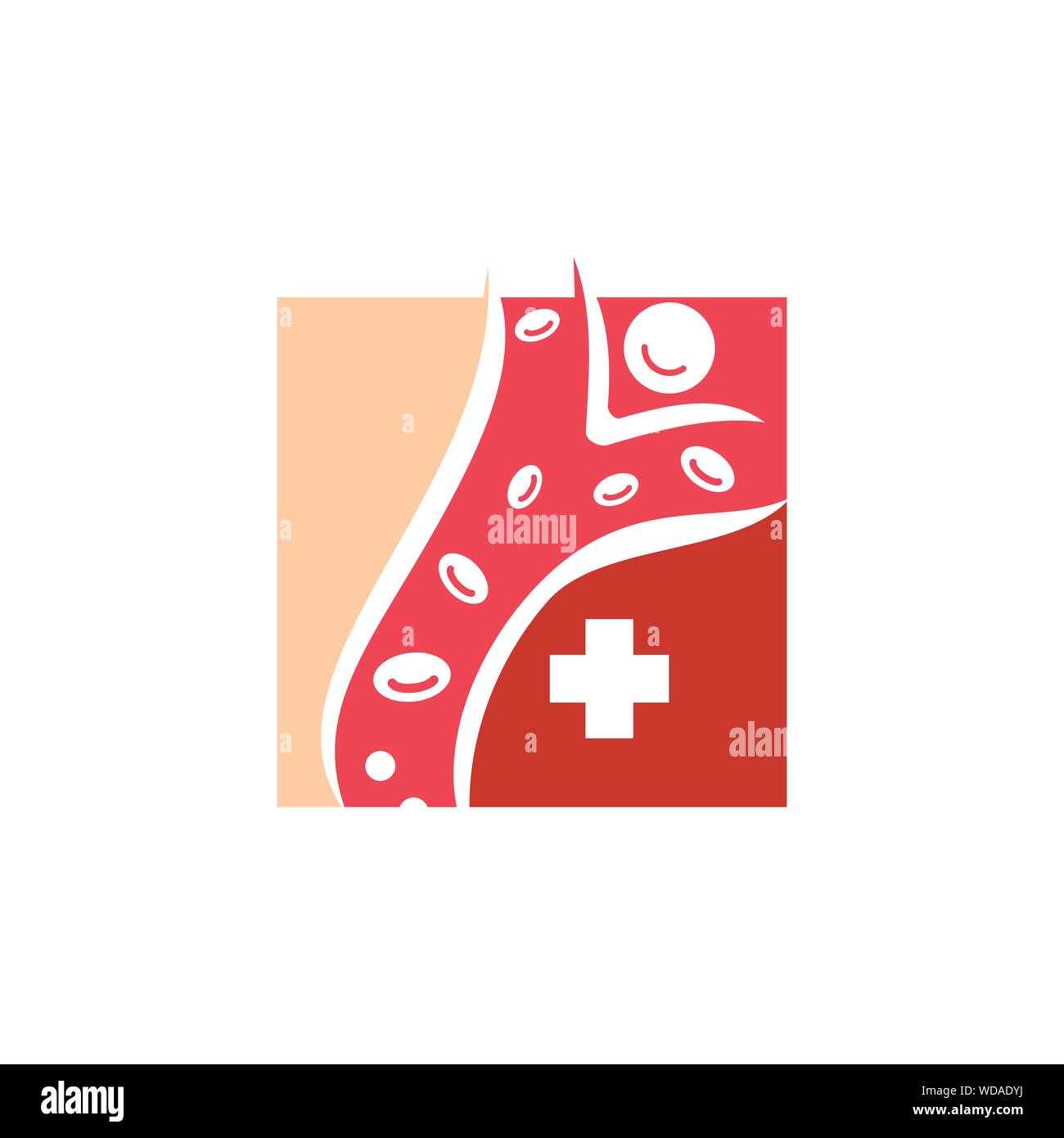 Cholesterol in artery health risk vector design Illustration Stock ...