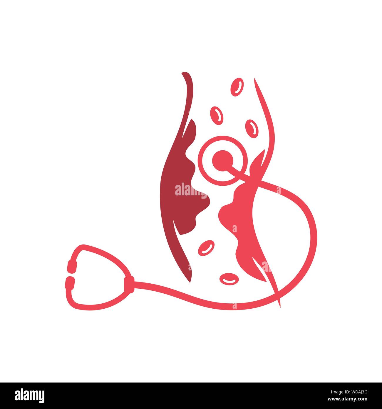 Cholesterol in artery health risk vector design Illustration Stock ...
