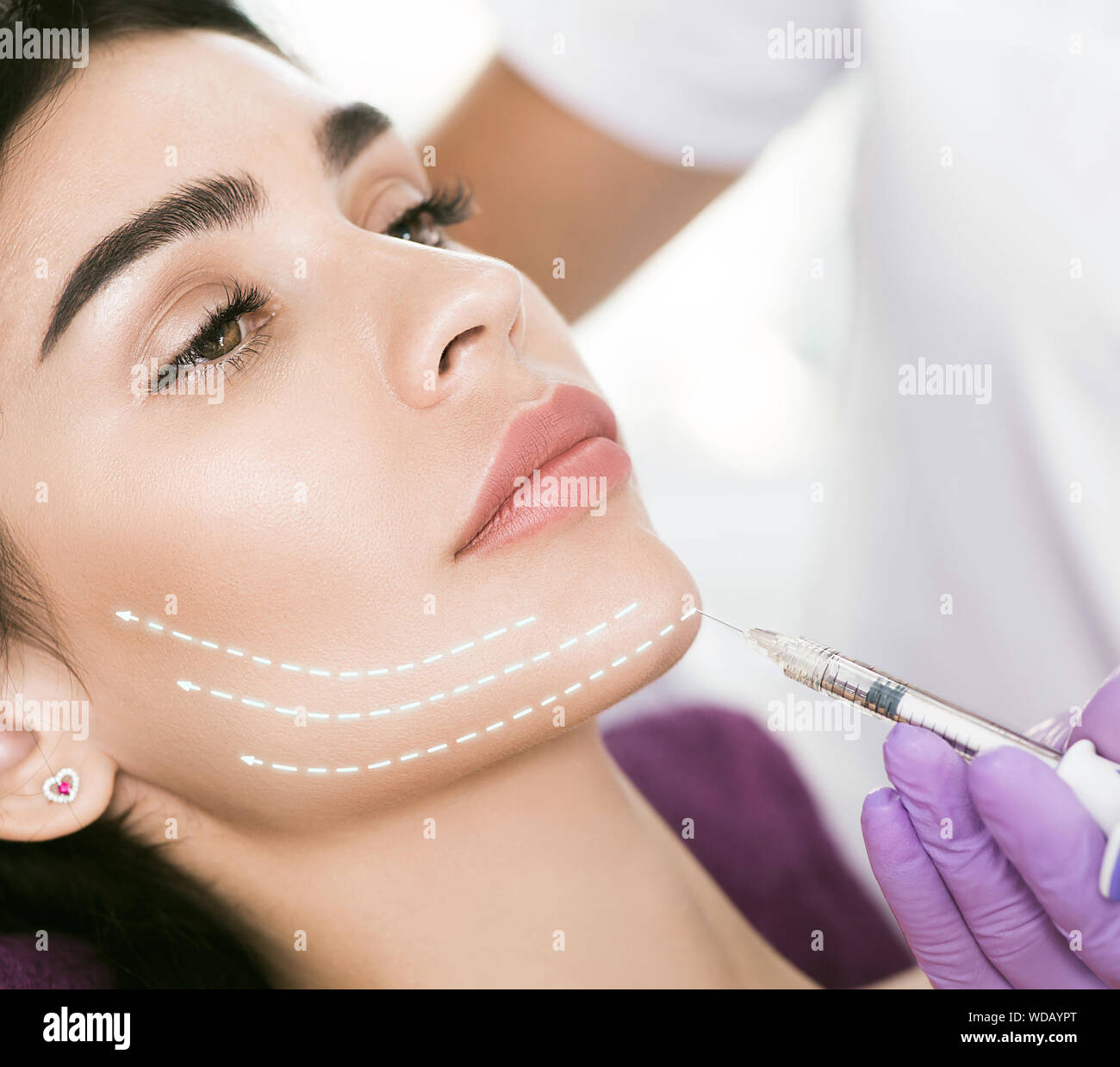 facelift using beauty injection, non surgery. Beautiful mid aged woman getting face injection