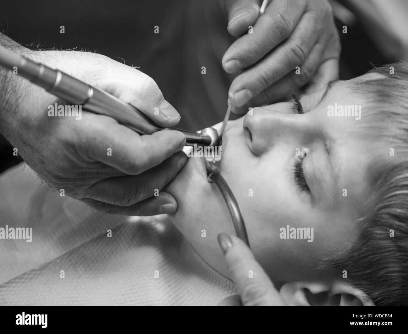 Drilling of teeth Black and White Stock Photos & Images Alamy