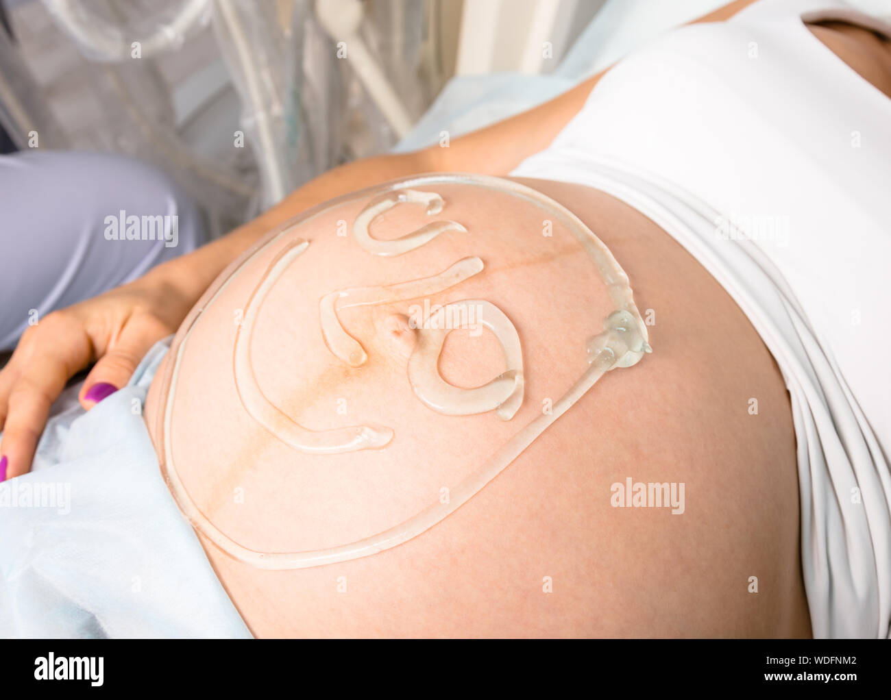 Smiley face painted with gel on a young pregnant woman's abdomen ready for obstetric or pregnancy ultrasound procedure Stock Photo