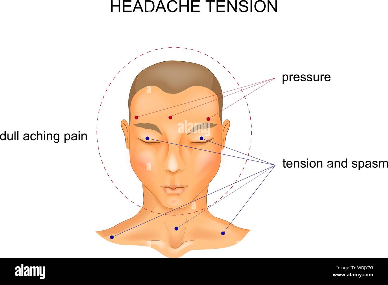 vector illustration of tension headache symptoms. pain Stock Vector